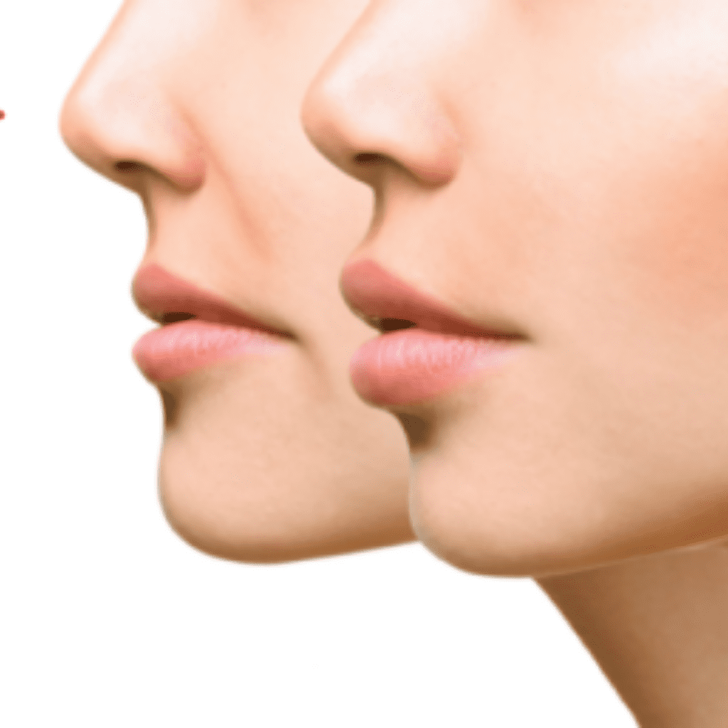 Aesthetic Clinic Ilkeston