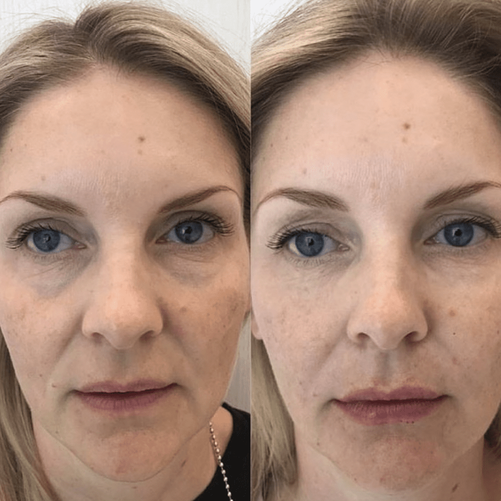 Aesthetic Clinic Ilkeston