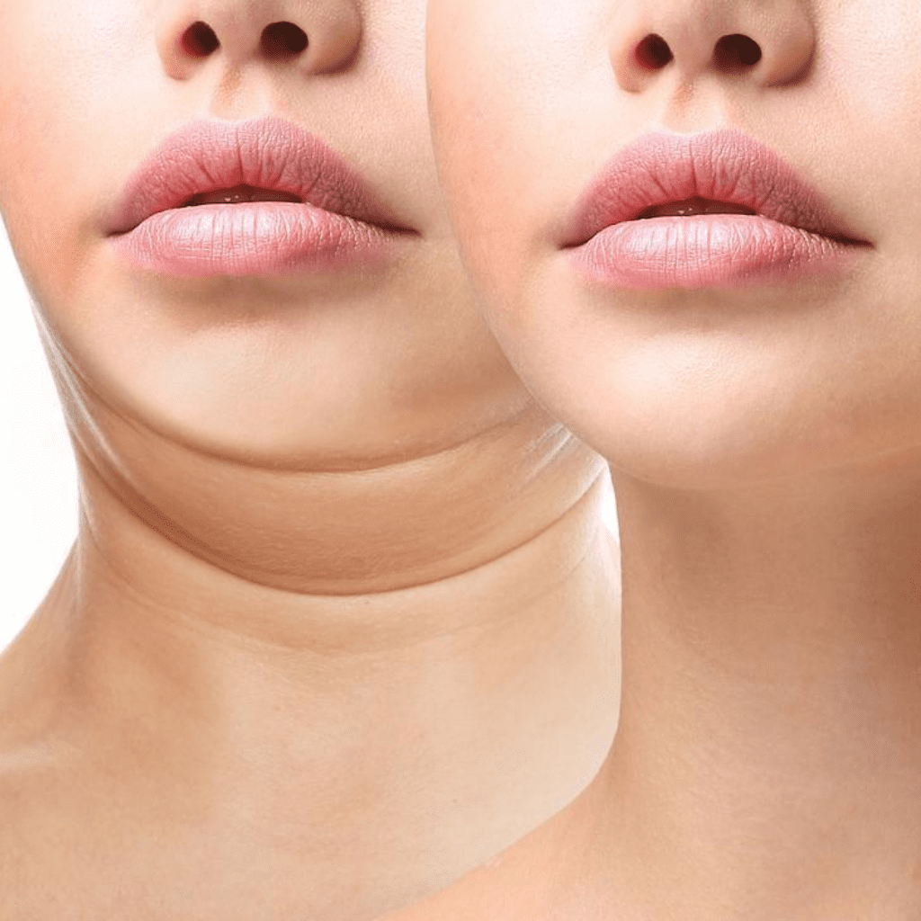 Aesthetic Clinic Ilkeston